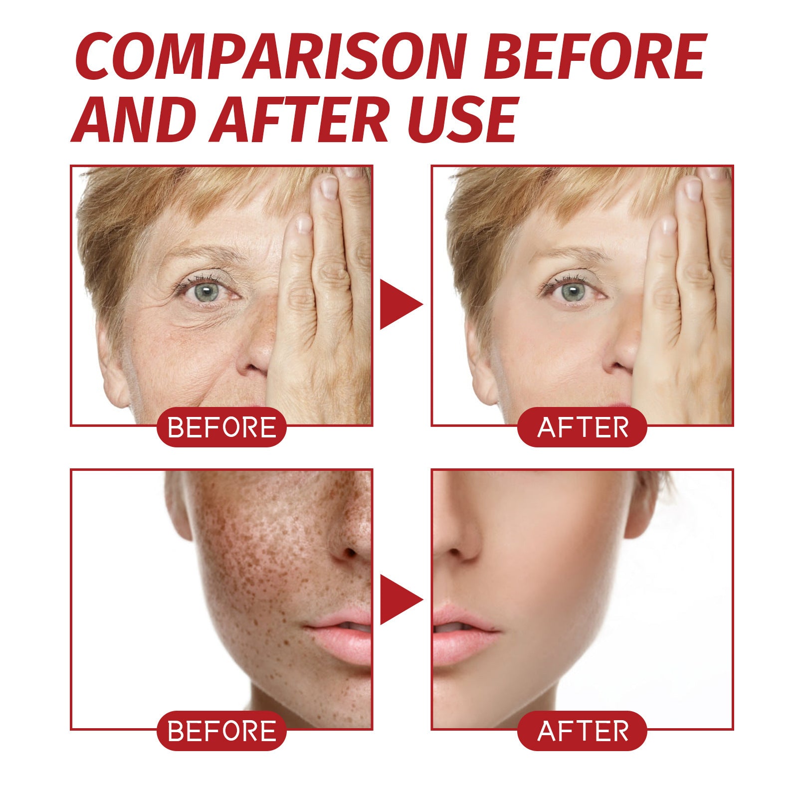 Spot Fading Facial Repair Dark Whitening Cream